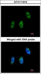 Anti-ELP3 antibody [N3C3] used in Immunocytochemistry/ Immunofluorescence (ICC/IF). GTX111912