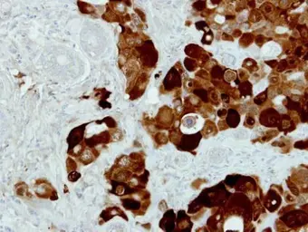 Anti-PIG3 antibody [N1C3] used in IHC (Paraffin sections) (IHC-P). GTX111926