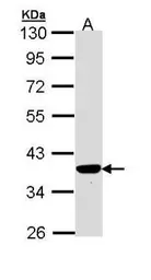 Anti-PIG3 antibody [N1C3] used in Western Blot (WB). GTX111926
