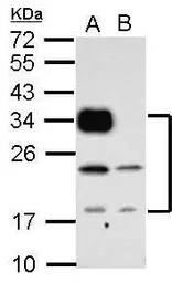 Anti-CD74 antibody used in Western Blot (WB). GTX111929