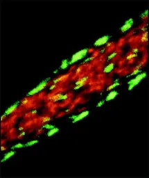 Anti-Vinculin antibody [VIN-11-5] used in Immunocytochemistry/ Immunofluorescence (ICC/IF). GTX11193