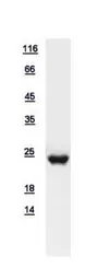 Human RAP1B protein, His tag. GTX111933-pro