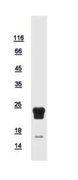 Human RPL17 protein, His tag. GTX111934-pro