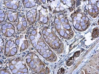 Anti-RPL17 antibody [N1C3-2] used in IHC (Paraffin sections) (IHC-P). GTX111934