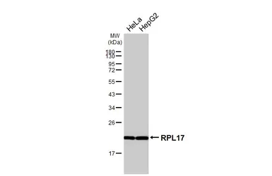 Anti-RPL17 antibody [N1C3-2] used in Western Blot (WB). GTX111934