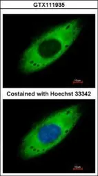 Anti-RPS3A antibody used in Immunocytochemistry/ Immunofluorescence (ICC/IF). GTX111935