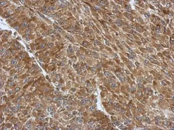 Anti-RPS3A antibody used in IHC (Paraffin sections) (IHC-P). GTX111935