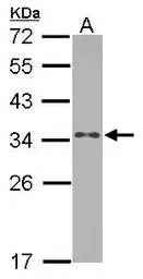 Anti-RPS3A antibody used in Western Blot (WB). GTX111935