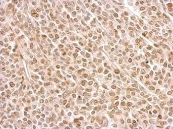 Anti-Securin antibody used in IHC (Paraffin sections) (IHC-P). GTX111938