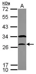 Anti-Securin antibody used in Western Blot (WB). GTX111938