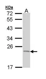 Anti-TNFAIP8 antibody [N1C3-2] used in Western Blot (WB). GTX111940