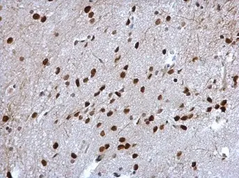 Anti-Cyclin T2 antibody [C2C3], C-term used in IHC (Paraffin sections) (IHC-P). GTX111944