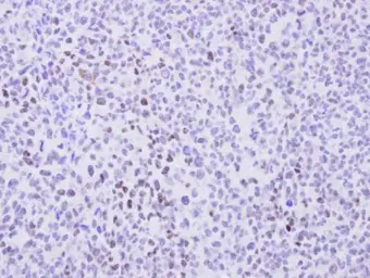 Anti-Cyclin T2 antibody [C2C3], C-term used in IHC (Paraffin sections) (IHC-P). GTX111944