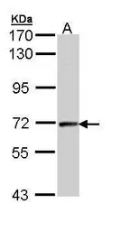 Anti-Cyclin T2 antibody [C2C3], C-term used in Western Blot (WB). GTX111944