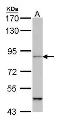 Anti-MARK1 antibody [N1N2], N-term used in Western Blot (WB). GTX111948