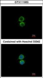 Anti-PIP5K1A antibody [N1N3] used in Immunocytochemistry/ Immunofluorescence (ICC/IF). GTX111953