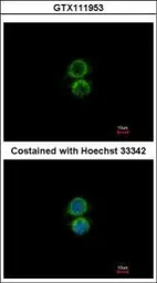 Anti-PIP5K1A antibody [N1N3] used in Immunocytochemistry/ Immunofluorescence (ICC/IF). GTX111953