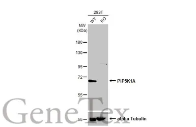 Anti-PIP5K1A antibody [N1N3] used in Western Blot (WB). GTX111953