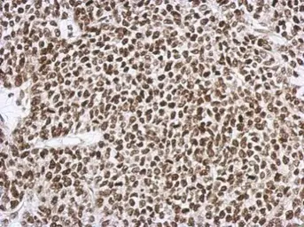 Anti-SNIP1 antibody [N1C3] used in IHC (Paraffin sections) (IHC-P). GTX111969