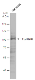 Anti-FLJ32786 antibody [N2C1], Internal used in Western Blot (WB). GTX111979