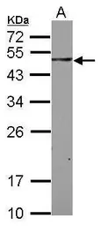 Anti-SH3BP5 antibody used in Western Blot (WB). GTX112002