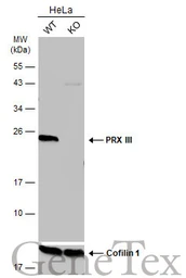 Anti-PRX III antibody [N1C3] used in Western Blot (WB). GTX112004
