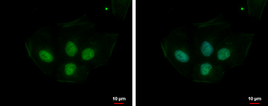 Anti-PRPS1L1 antibody used in Immunocytochemistry/ Immunofluorescence (ICC/IF). GTX112011