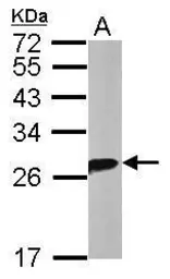 Anti-14-3-3 theta antibody [N1C3-2] used in Western Blot (WB). GTX112026