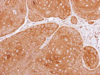 Anti-14-3-3 theta antibody [N1C3-2] used in IHC (Paraffin sections) (IHC-P). GTX112026