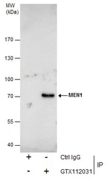 Anti-Menin antibody [N1C1] used in Immunoprecipitation (IP). GTX112031