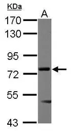 Anti-Menin antibody [N1C1] used in Western Blot (WB). GTX112031