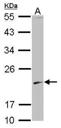 Anti-SKP1 antibody used in Western Blot (WB). GTX112041