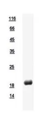 Human DUSP21 protein, His tag. GTX112045-pro