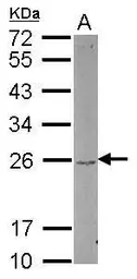 Anti-DUSP22 antibody [N1C3] used in Western Blot (WB). GTX112048