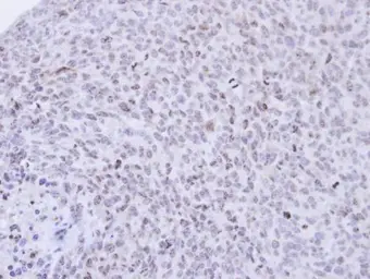 Anti-PCNP antibody [N1N2], N-term used in IHC (Paraffin sections) (IHC-P). GTX112059