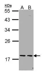 Anti-PCNP antibody [N1N2], N-term used in Western Blot (WB). GTX112059