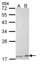Anti-Phospholipase A2 XIIA antibody [N1C1] used in Western Blot (WB). GTX112060