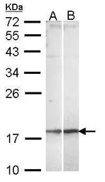 Anti-NKIRAS2 antibody [C2C3], C-term used in Western Blot (WB). GTX112075