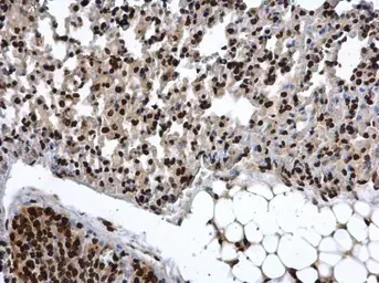 Anti-COMMD7 antibody used in IHC (Paraffin sections) (IHC-P). GTX112076