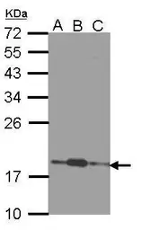 Anti-COMMD7 antibody used in Western Blot (WB). GTX112076