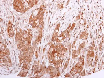 Anti-BCL2L12 antibody used in IHC (Paraffin sections) (IHC-P). GTX112088