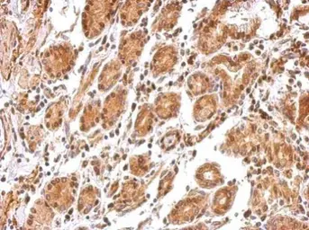 Anti-BCL2L12 antibody used in IHC (Paraffin sections) (IHC-P). GTX112088