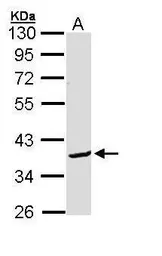 Anti-BCL2L12 antibody used in Western Blot (WB). GTX112088