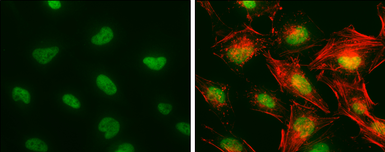 Anti-CA150 antibody used in Immunocytochemistry/ Immunofluorescence (ICC/IF). GTX112099