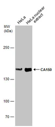 Anti-CA150 antibody used in Western Blot (WB). GTX112099