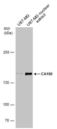Anti-CA150 antibody used in Western Blot (WB). GTX112099