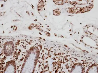Anti-CA150 antibody used in IHC (Paraffin sections) (IHC-P). GTX112099