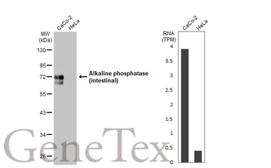 Anti-Alkaline phosphatase (intestinal) antibody used in Western Blot (WB). GTX112100