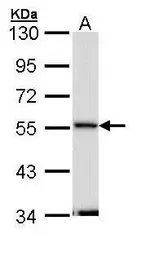 Anti-Septin 11 antibody [N1C1] used in Western Blot (WB). GTX112103