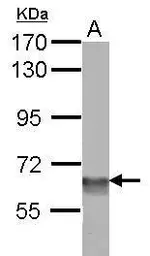 Anti-SMARCD3 antibody [N2C3] used in Western Blot (WB). GTX112107